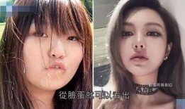 爆料小猪整容视频大全下载,视频大全下载一览