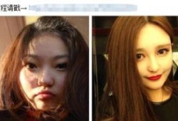 爆料小猪整容视频大全下载,视频大全下载一览