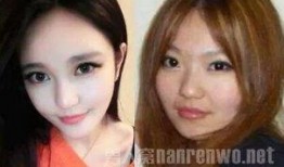 爆料小猪整容视频大全下载,视频大全下载一览